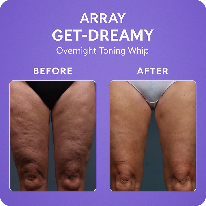 Say goodnight to loose skin.